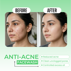 Anti Acne Face Wash