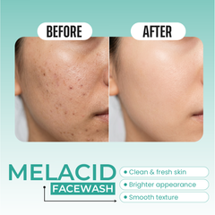 Melacid Facewash