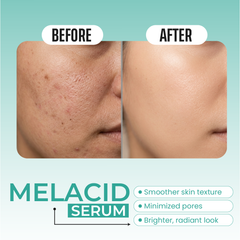 Melacid Serum