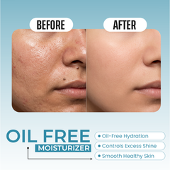 OIL FREE MOISTURIZER