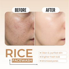 Rice Extract Face Wash