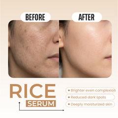Rice Extract Serum