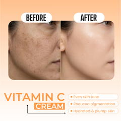 Vitamin C Cream