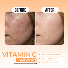 Vitamin C Face Wash