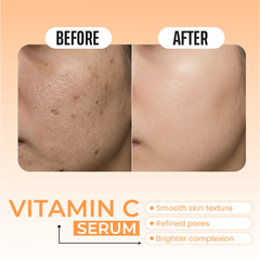 Vitamin C Serum